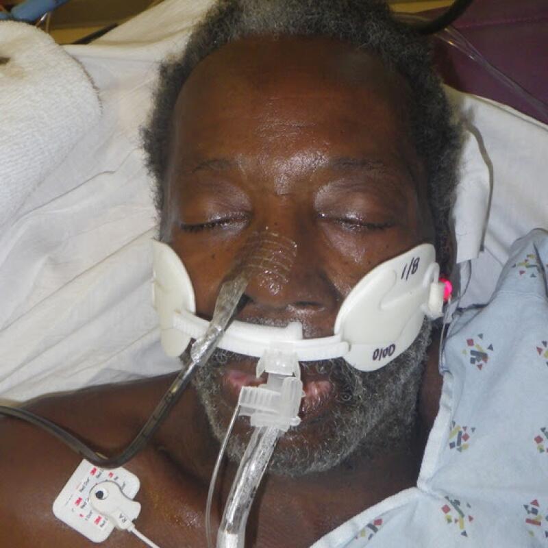 a man lays in a hospital bed intubated