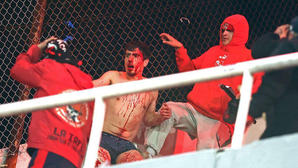 A bloodied supporter